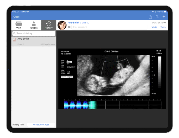 OBGYN ultrasounds wave gif
